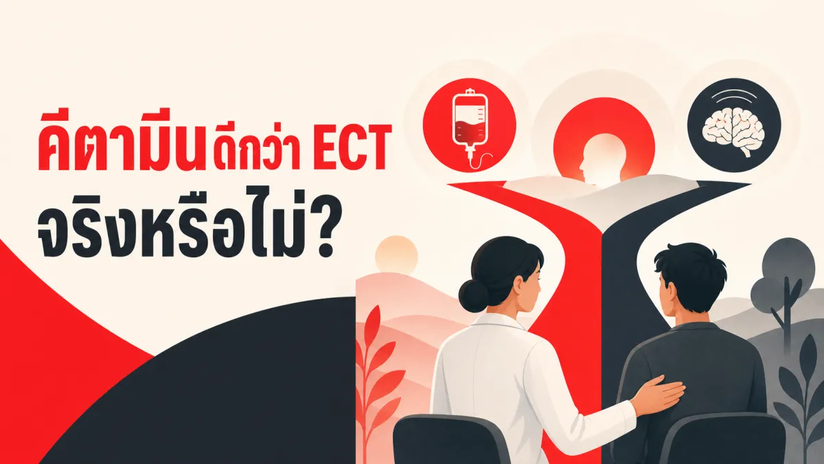 คีตามีนได้ผลดีกว่าช็อตไฟฟ้า (ECT) สำหรับโรคซึมเศร้าดื้อยาจริงหรือ งานวิจัยสุ่มตัวอย่าง 403 คนใน NEJM ปี 2023 เผยคำตอบที่หลายคนคาดไม่ถึง