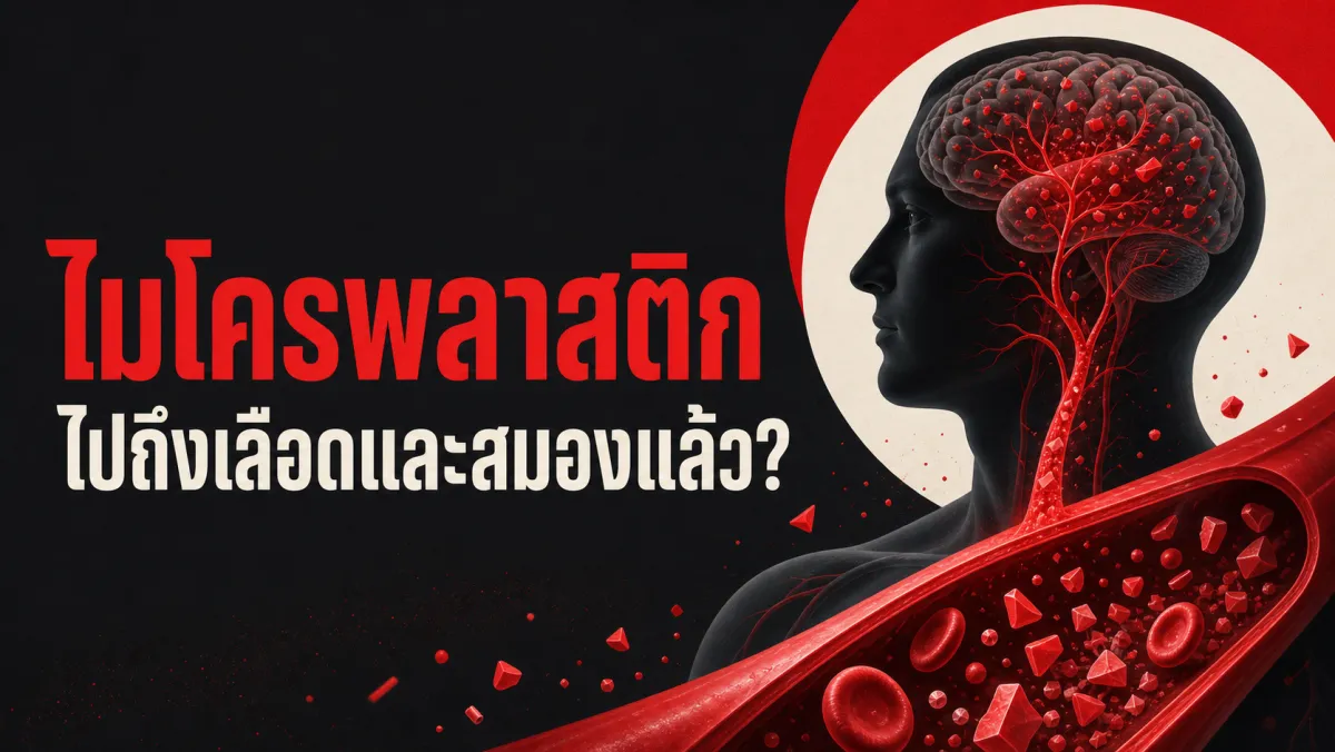 พลาสติกจิ๋วในเลือด หลอดเลือดคอ และเนื้อสมอง: ทำไมคนที่ตรวจพบพลาสติกในคราบไขมันหลอดเลือดเสี่ยงหัวใจวาย-อัมพาต-เสียชีวิตสูงกว่าถึง 4.5 เท่า